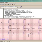 Программное обеспечение ArMaSoft-12-Cardio