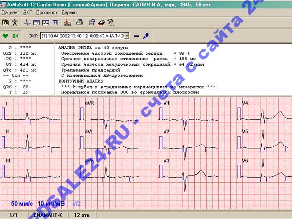 Программное обеспечение ArMaSoft-12-Cardio